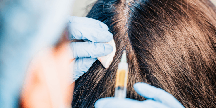 japanese scap cleaning treatment