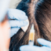 japanese scap cleaning treatment